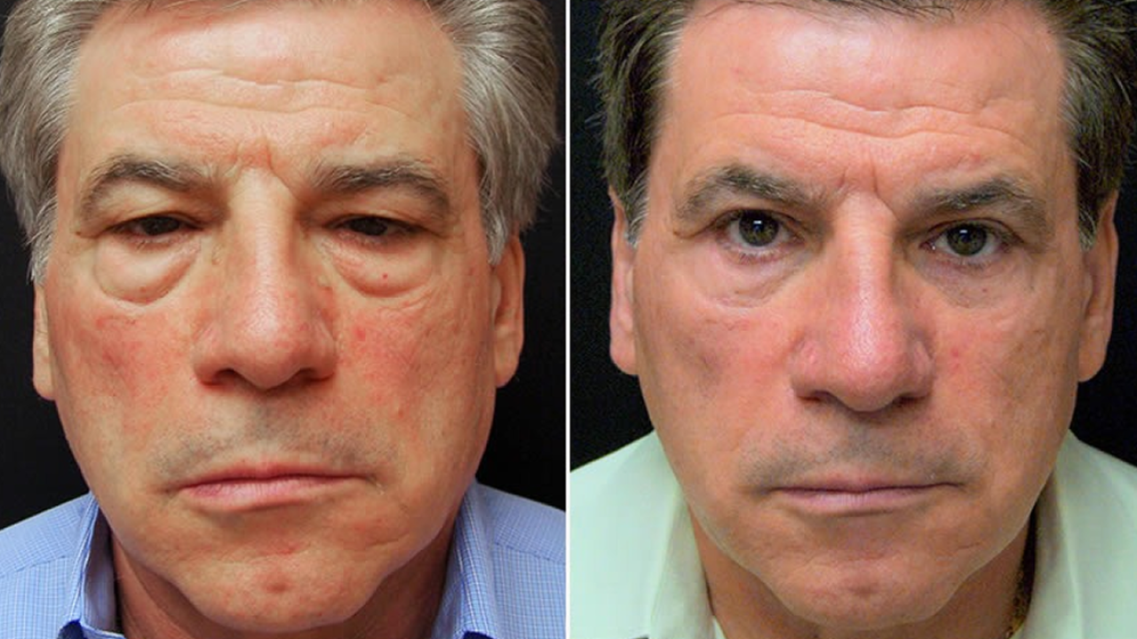 WhatsApp Image 2026-01-22 at 11.39.20 1