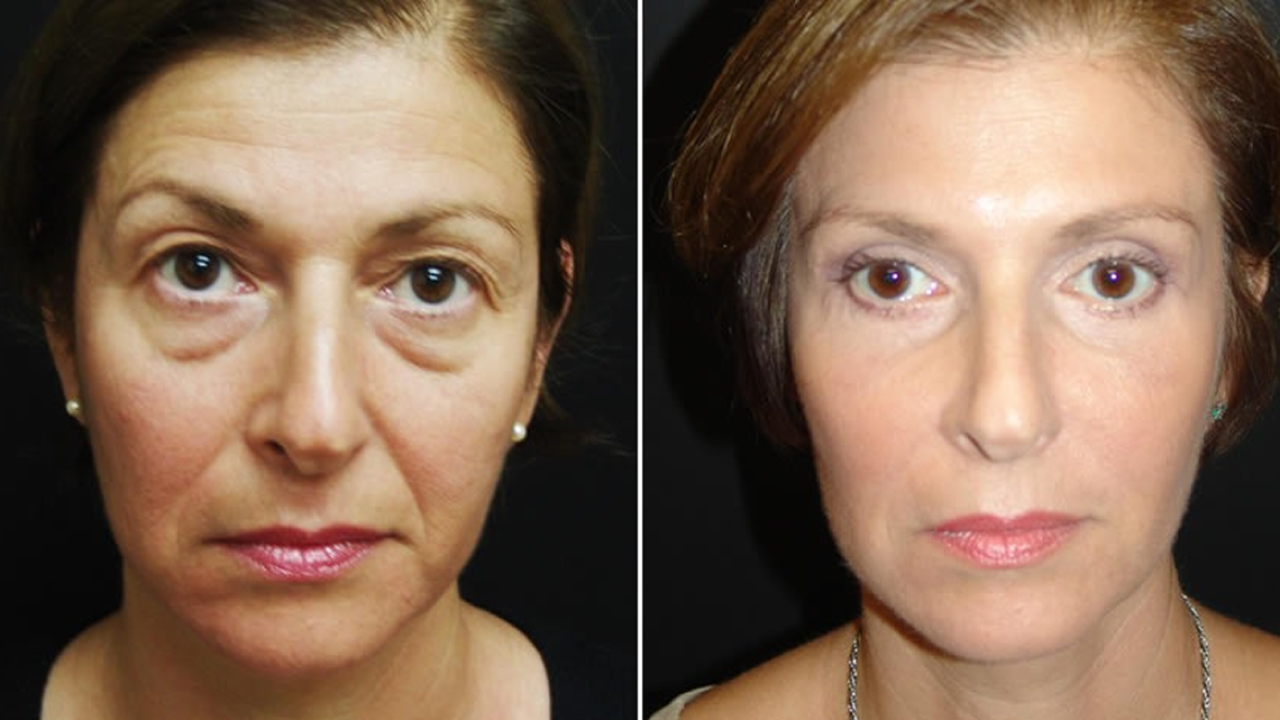 WhatsApp Image 2026-01-22 at 11.39.26 1