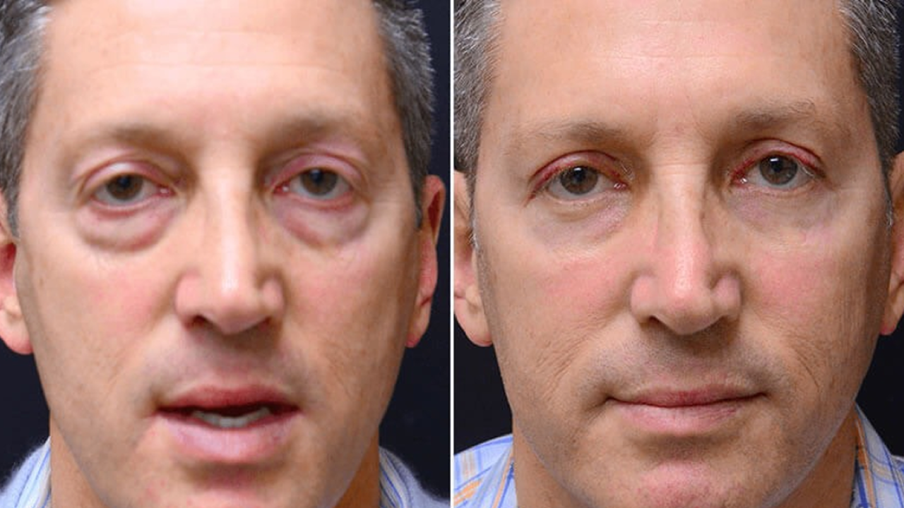 WhatsApp Image 2026-01-22 at 11.39.36 1